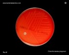 Listeria monocytogenes hemolysis on blood agar